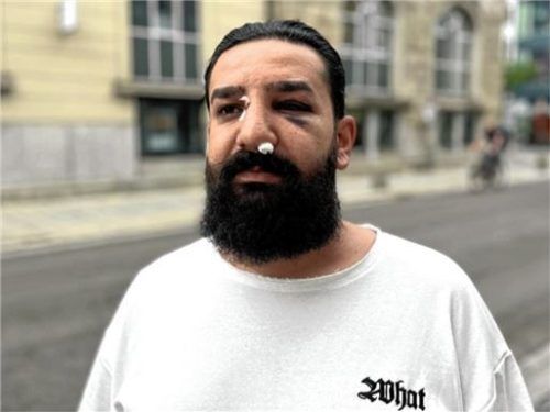 Vor seinem Friseursalon in Rosenheim wurde Ali Zeinab mehrfach ins Gesicht geschlagen, als er mehreren Mädchen helfen wollte. Foto Huber/privat