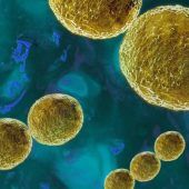 Streptokokken: Wer im Alltag gefährdet ist