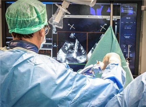 Professor Dr. Christian Thilo bei einen der ersten Eingriffe im neuen, dritten Herzkatheterlabor am Romed-Klinikum Rosenheim. Foto RoMed Kliniken
