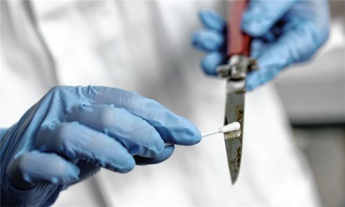 Unfassbare Tat: Ein 31-jähriger Mann aus Raubling soll seinen Vater mit dem Messer umgebracht haben. Die Ermittlungen (Symbolbild) laufen noch. Foto Rolf Vennenbernd(dpa