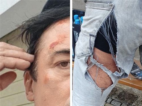 Zerkratztes Gesicht, zerrissene Jeans: Diese Bilder fügte Michael Herweg seiner Strafanzeige gegen einen Polizeibeamten bei, der ihn beim Echelon-Festival kontrolliert und seinen Angaben nach ungebührlich behandelt hatte.