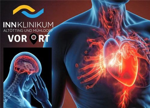 Zu drei großen Gesundheitsthemen bietet das InnKlinikum spannende Vorträge. Vor Ort beantworten die Ärzte Fragen. Den Auftakt macht ein Abend über die Volkskrankheiten Herzinfarkt und Schlaganfall.