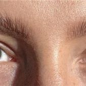 „Ich dachte, ich muss sterben“