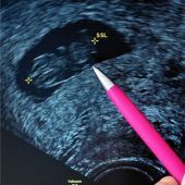 Frauen dürfen nicht kriminalisiert werden