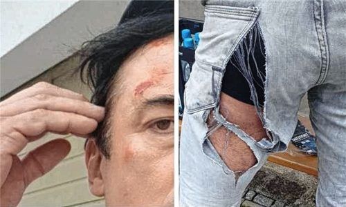 Schürfwunden im Gesicht und zerrissene Jeans: Diese Bilder fügte Michael Herweg seiner Strafanzeige gegen einen Polizeibeamten bei, der ihn beim Echelon-Festival kontrolliert und verletzt haben soll. Foto privat