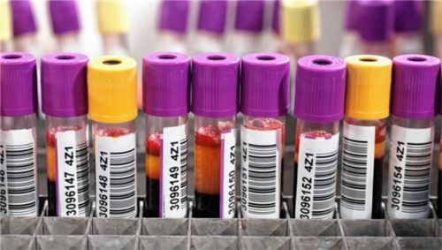 Teströhrchen mit Blutproben für die Laboruntersuchung stehen auf einem Tisch.Foto DPA