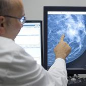 Früherkennung: Was die Kassen übernehmen