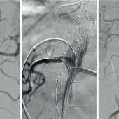 Tickende Gefahr gebannt