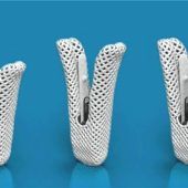 Mini-Klammer schenkt Lebensfreude