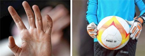 Immer wieder kommen Fälle von sexuellem Missbrauch in Sportvereinen an die Öffentlichkeit. Verbände empfehlen Vereinen klare Handlungen. Fotos dpa