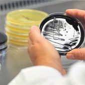 Legionellen in der Leitung?