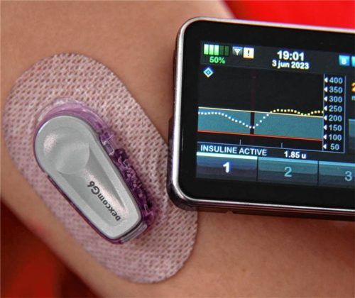 Blutzucker überwachen, Insulin spritzen, Katheter wechseln und, und, und. Der Umgang mit Typ-1-Diabetes gleicht einem Vollzeitjob. Foto IMAGO