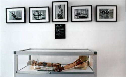 Historische Fotos vermitteln einen Eindruck vom Klinikalltag früher. Auch historische Prothesen und Orthesen sind zu sehen. Foto Michaela Thomas