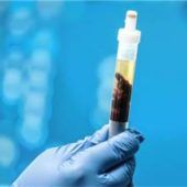 Sicherheit bei HIV und Hepatitis