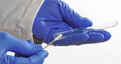 Um sich als potenzieller Stammzellenspender registrieren zu lassen, reicht ein Wangenabstrich. Foto IMAGO/CHROMORANGE