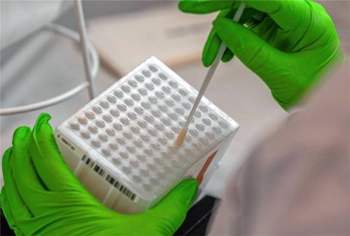Die Typisierung ist die Bestimmung der spezifischen Gewebemerkmale eines potenziellen Stammzellenspenders, um sie mit denen von Blutkrebspatienten weltweit abzugleichen. Dies geschieht meist durch einen einfachen Wangenabstrich oder eine Blutprobe. Foto dpa