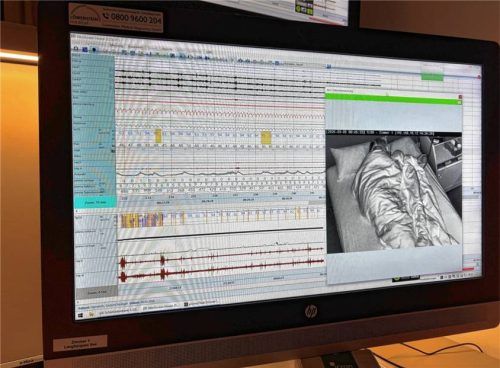 Nach der Verkabelung durch einen Schlafassistenten werden sämtliche Daten wie Puls, Sauerstoffsättigung und Atmung kontrolliert. Fotos Eiglmeier