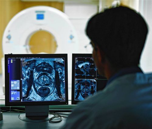 Ein Mitarbeiter betrachtet in einem Kontrollraum des Deutschen Krebsforschungszentrums (DKFZ) auf einem Monitor das Querschnittsbild einer Prostata. Foto dpa