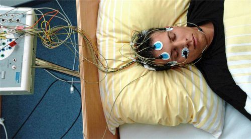 Ein Patient des Schlaflabors der Universitätsklinik Freiburg liegt schlafend im Bett – am Kopf mit Elektroden bestückt. Foto dpa